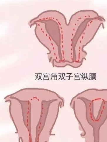 2026年在首都医科大学附属北京朝阳医院做三代试管婴儿指南！怀孕成功率多少供您参考