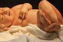 烟台做试管婴儿要多少钱？烟台试管婴儿医院推荐